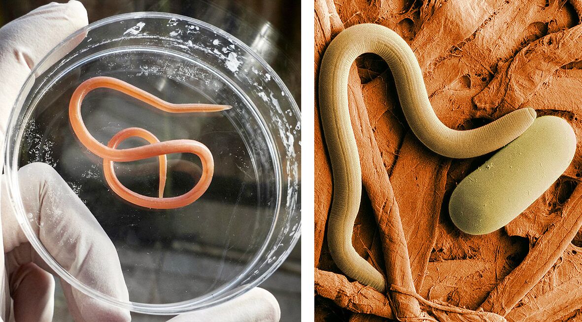 Parasitos no corpo humano