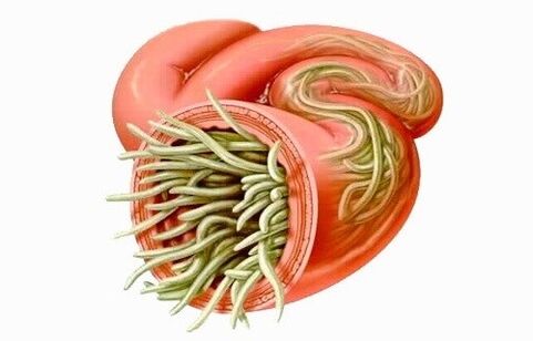 Os vermes son parasitos no intestino humano